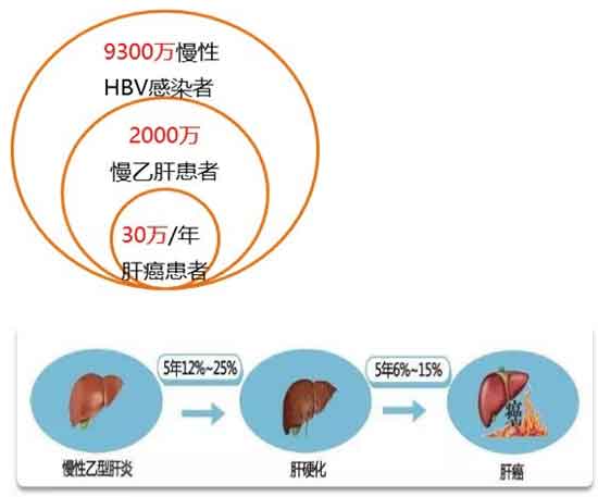 郑州哪里肝病医院治疗乙肝比较好