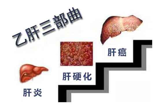 上海瑞金医院肝病教授在河南省医药院附属医院会诊中:要的就是专业