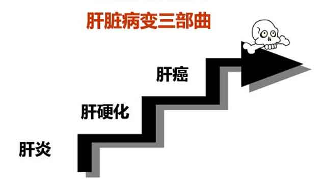 郑州有哪家医院治疗肝硬化比较好