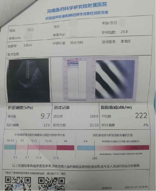 在河南省内哪家医院治疗肝硬化比较好