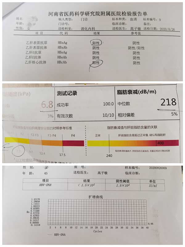 郑州哪个医院看乙肝技术比较好
